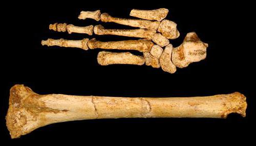 К чему снятся человеческие кости?