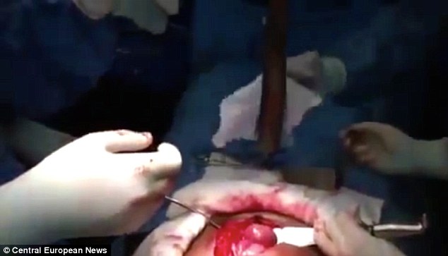 The hospital launched an investigation after the operation was filmed and posted on the internet without the man