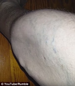 A man has captured bizarre footage of his calf muscle twitching and moving by itself