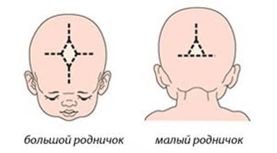 Большой и малый роднички у ребенка