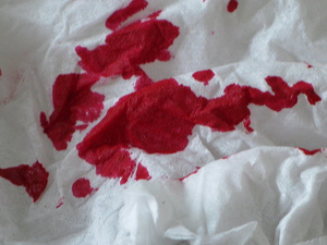 Одежда в крови
