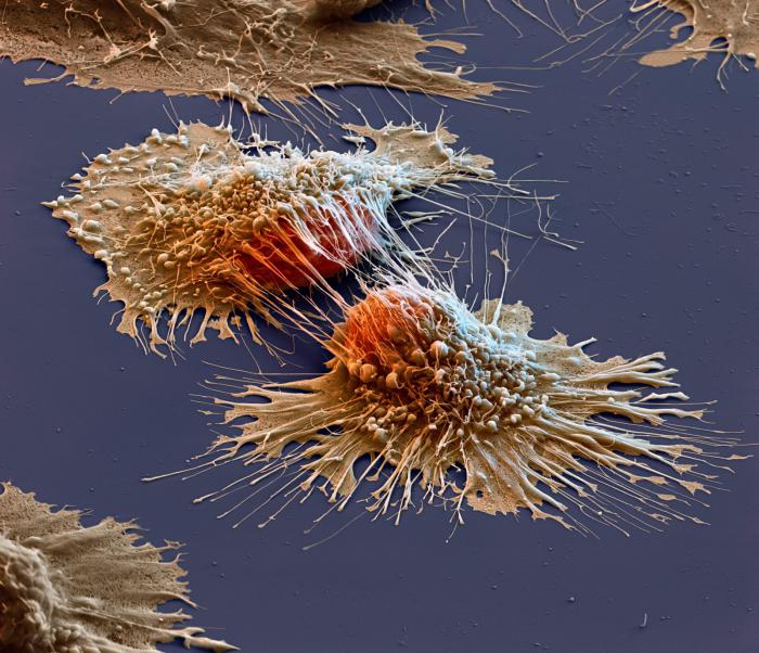 раковые клетки, фото